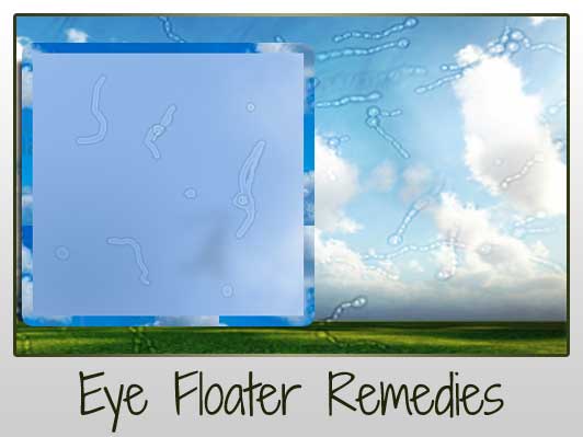 Cure Eye Floaters Naturally (Remedies from around the Web) – Penny 
