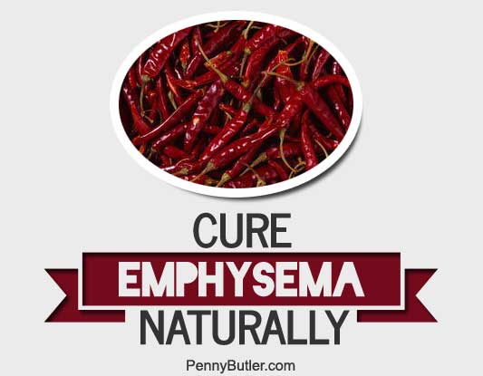 Cure Emphysema Naturally (120+ COPD remedies from around the web)