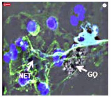 young-neutrophil-intoxicated-by-graphene-oxide